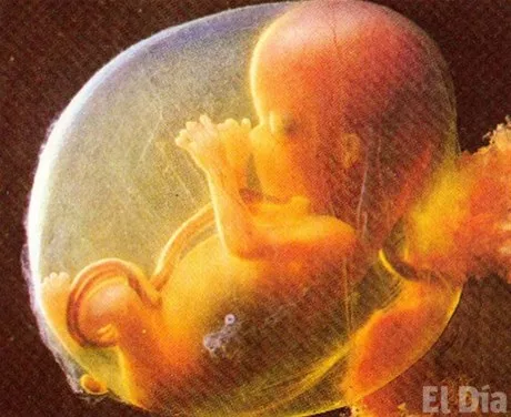 http://eldia.com.do/image/article/7/460×390/0/B020F799-EA5D-49E6-8674-F0E6D56686C0.jpeg