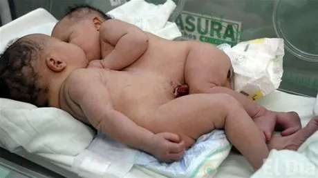 http://eldia.com.do/image/article/25/460×390/0/BAFB1F9C-6D6E-4B43-A8D9-C5E145690B98.jpeg