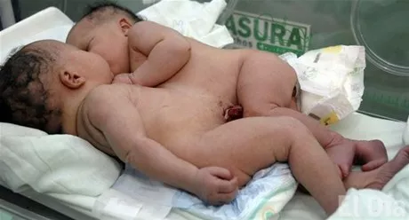 http://eldia.com.do/image/article/25/460×390/0/CC2D0851-3350-4B28-B9FB-5268AFBAD09B.jpeg