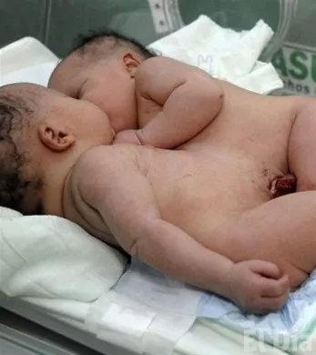 http://eldia.com.do/image/article/25/460×390/0/FCF65777-ED4D-4851-AC2A-37635B4FD370.jpeg