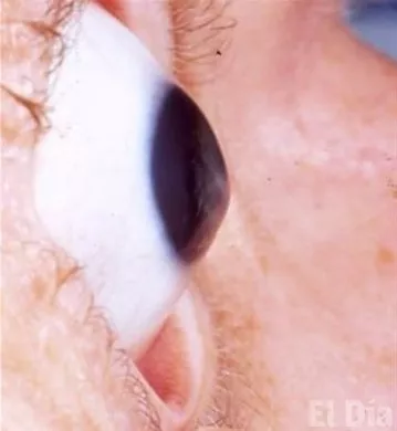 http://eldia.com.do/image/article/30/460×390/0/93D3F9CC-DB8A-4682-8D84-037B0B13B821.jpeg