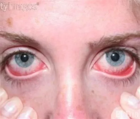 http://eldia.com.do/image/article/42/460×390/0/9B8F8755-9046-4FA0-A706-8A6AE47A8BAF.jpeg