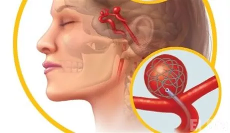 http://eldia.com.do/image/article/84/460×390/0/737DCEE5-5865-4748-ACA2-3D6B5C97A04A.jpeg