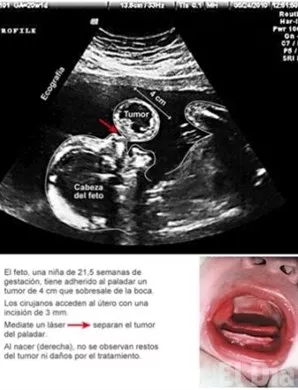 http://eldia.com.do/image/article/105/460×390/0/F606C91D-70EF-41E6-8F48-1B52432F271C.jpeg
