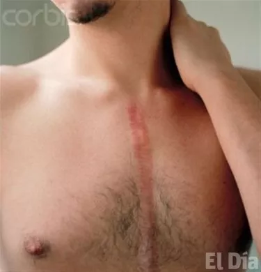 http://eldia.com.do/image/article/119/460×390/0/362ACABA-2C12-4059-A3C4-03B73BA91777.jpeg