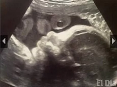 http://eldia.com.do/image/article/126/460×390/0/B3C0164E-6B51-46BC-B715-32DBA6ED43A9.jpeg