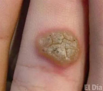 http://eldia.com.do/image/article/127/460×390/0/E19E096A-89F1-45EA-8B5F-A2182644F1D6.jpeg