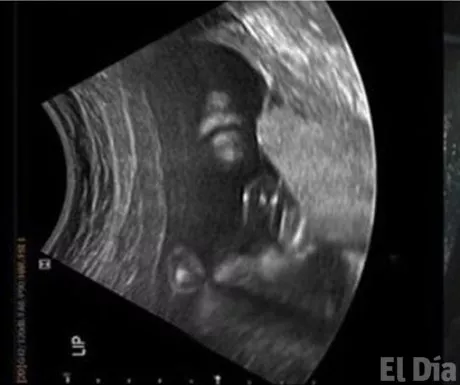 http://eldia.com.do/image/article/138/460×390/0/2BA461AE-AF61-4C0D-B269-A0B2B41C9F96.jpeg