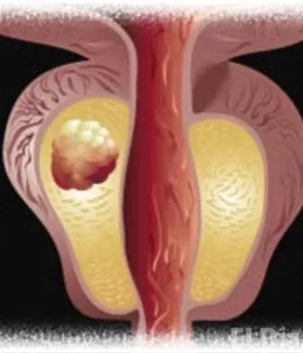 http://eldia.com.do/image/article/141/460×390/0/5CC0F9A0-5B10-4B53-A58F-C834CC68EFE9.jpeg