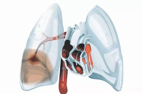 http://eldia.com.do/image/article/153/460×390/0/0EB6242F-E5F2-4F92-B172-E0643587097B.jpeg