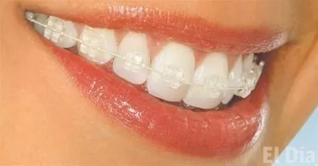 http://eldia.com.do/image/article/151/460×390/0/F2FD79CD-EA94-476E-BDAB-2F4CAC7F441A.jpeg