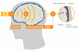 ¿Qué tan peligroso es un golpe en la cabeza?