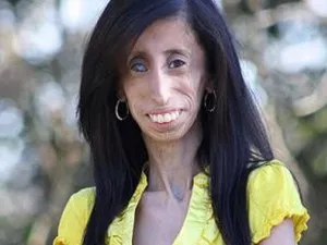 Lizzie Velasquez Lizzie Velasquez