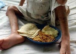 15.6 por cientos de los dominicanos padece de subnutrición, según la FAO