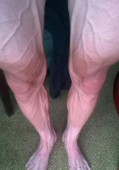 Ciclista muestra foto de sus piernas tras 18 etapas del Tour de Francia