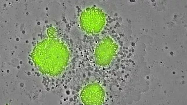 bacteria-egionela-barcelona-muertes–644×362