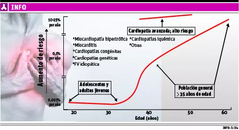 La muerte súbita representa una  epidemia para  países occidentales