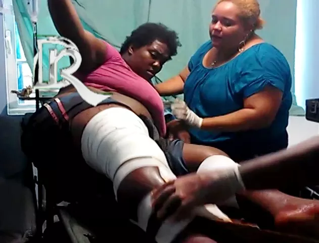 MUJER HERIDA POR UNA PATRULLA POLICIAL EN CABARETE II