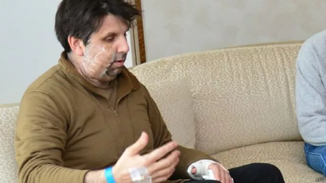 150308163044_lippert_624x351_afp