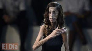 La inspiradora historia de superación de Lizzie Velásquez, «la mujer más fea del mundo»