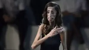 La inspiradora historia de superación de Lizzie Velásquez, «la mujer más fea del mundo»