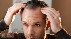 Aquí te decimos como tratar la alopecia de forma natural