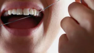 Algunos equipos para blanquear los dientes en casa pueden dañar el esmalte dental o enamel, según advierte el sistema de salud pública británico.