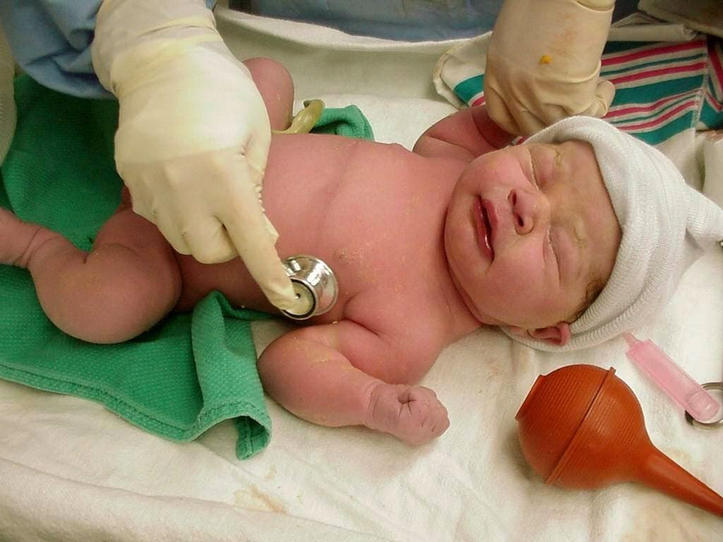 Capacitan médicos para reducir morbimortalidad neonatal en Maternidad de Los Mina