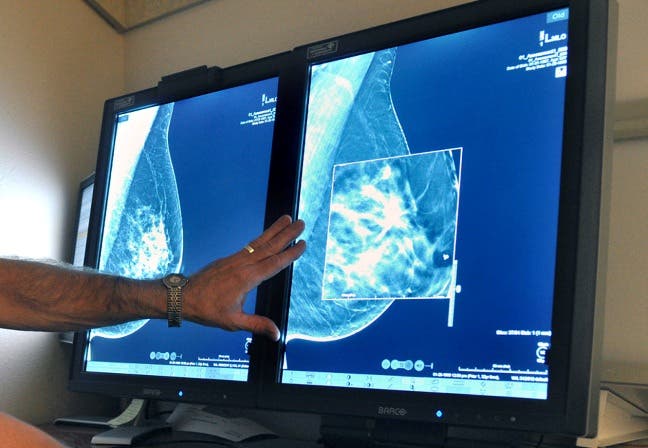 Recomiendan iniciar mamografías a los 45 años, no a los 40