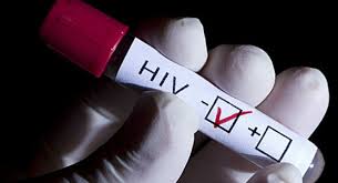 Un medicamento contra el alcoholismo podría contribuir a eliminar el virus del SIDA