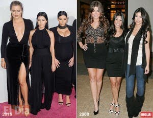 Los peligros de las operaciones al estilo Kardashian