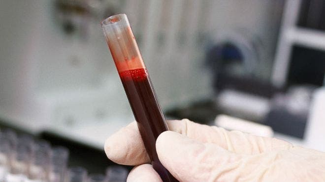 El nuevo examen de sangre que revela problemas cardíacos hereditarios «ocultos»