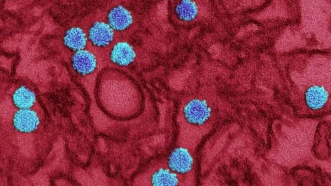 Trece  grandes incógnitas sobre el virus zika