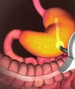 Píldora combinada para la  hepatitis C