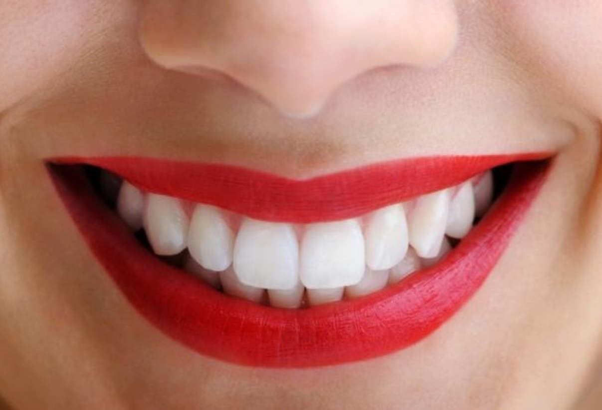 ¿Cómo se logra una dentadura perfecta?