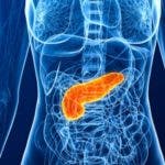 Carcinoma del páncreas y vesícula: los cánceres más mortales