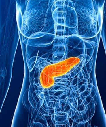 Carcinoma del páncreas y vesícula: los cánceres más mortales