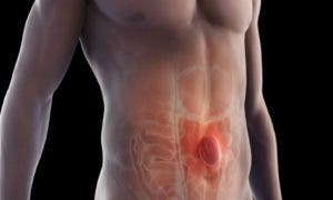 Hernias de la pared abdominal afectan más al sexo masculino