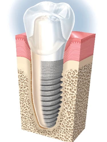 Jornada de implantes en la Fundación Dr. Garg