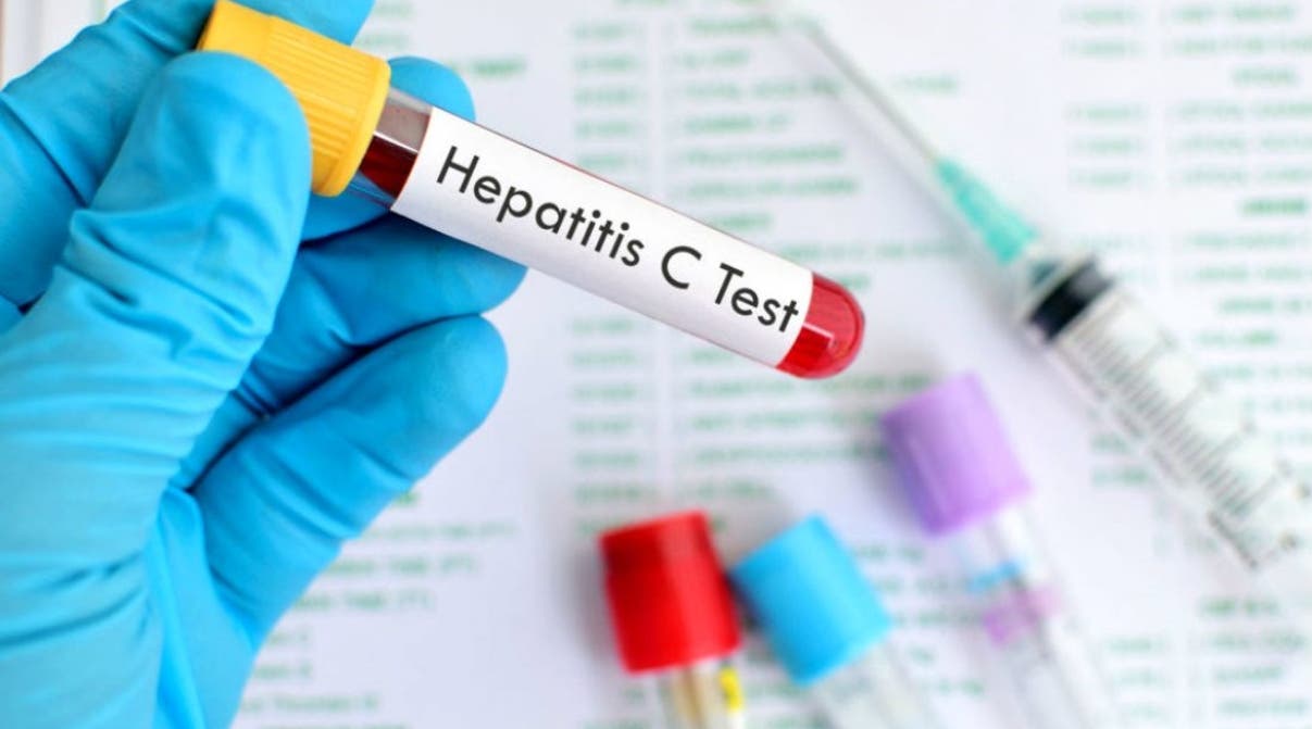 OMS: Los casos de hepatitis infantil de origen desconocido superan el millar