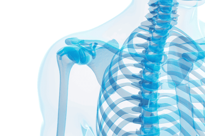 Heteroplasia ósea progresiva, una enfermedad rara de huesos fuera de lugar