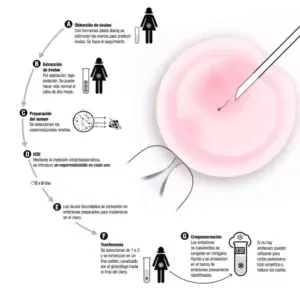 Fertilización in vitro, rayo de luz para madres