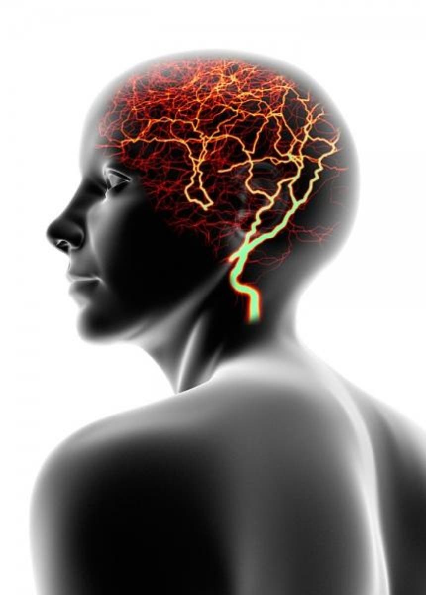 La epilepsia: efectos de una alteración eléctrica excesiva en el cerebro