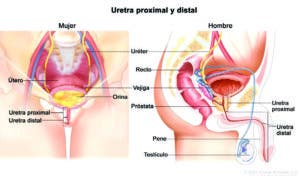 Estrechez uretra no se puede pasar por alto