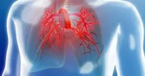 La hipertensión pulmonar, una enfermedad grave, rara y de difícil diagnóstico