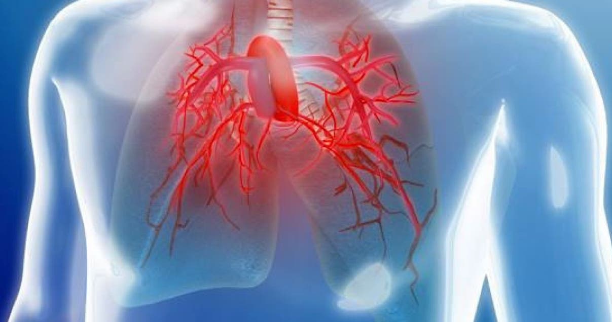 La hipertensión pulmonar, una enfermedad grave, rara y de difícil diagnóstico