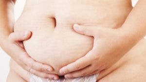 Qué causa la «barriga de mamá» de la que muchas mujeres no consiguen deshacerse y cómo se puede combatir