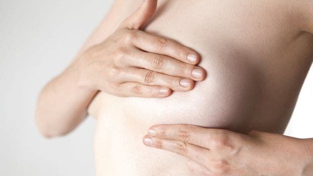 Qué es el cáncer inflamatorio de mama y por qué es tan difícil de diagnosticar