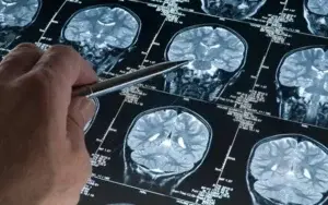 Identificada una molécula con potencial terapéutico contra el Alzheimer