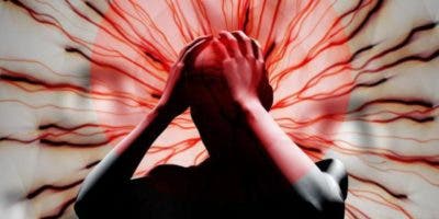Malformaciones arteriovenosas producen hemorragia cerebral